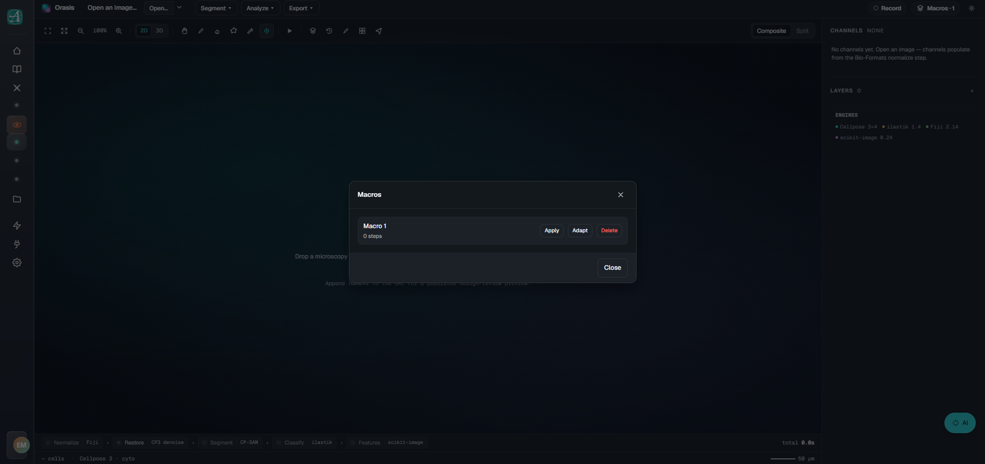Orasis macros dialog — the rigid, click-based way